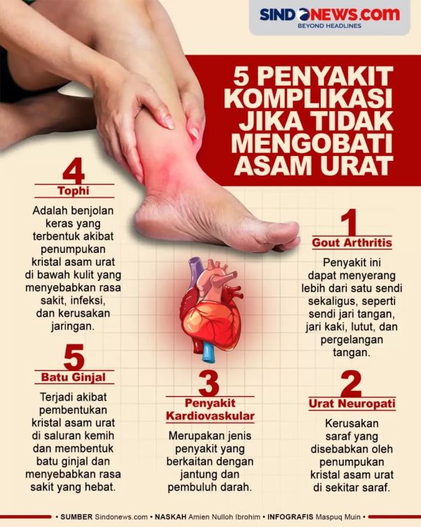 5 Ciri Ciri Asam Urat Di Pergelangan Kaki Dan Cara Alami Mengobatinya Halaman 2 4162